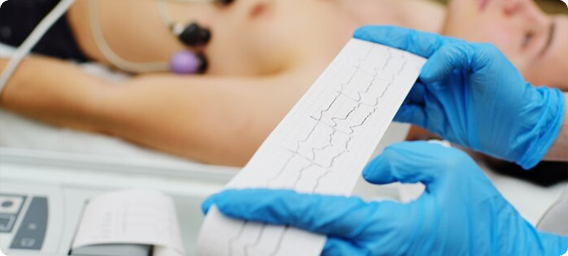 ECG